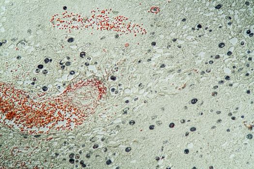 Amoeba parasite tissue under the microscope 200x