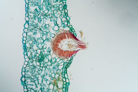 Pea rust Parasitic mushroom under the microscope 100x