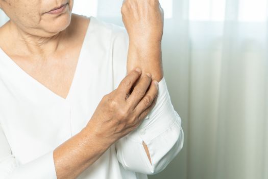 senior women scratch hand the itch on eczema arm, healthcare and