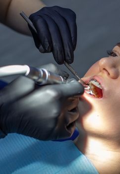 A woman at a dentist's appointment to replace arches with braces.