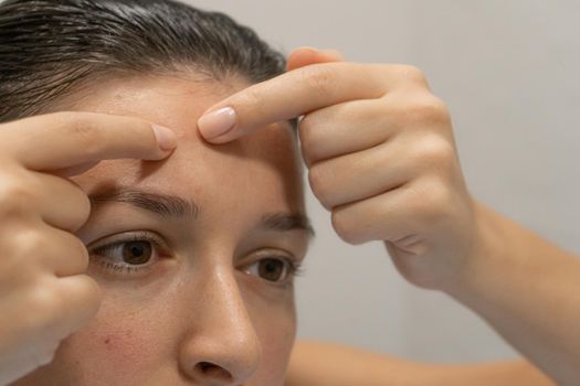Close-up portrait of a girl squeezes out a pimple on her forehead. An awkward moment before a date
