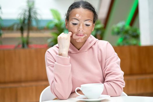Black african american woman with vitiligo pigmentation skin problem indoor dressed pink hoodie