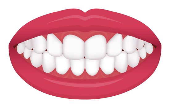 Teeth trouble ( bite type / crooked teeth ) vector illustration / even teeth., normal teeth 