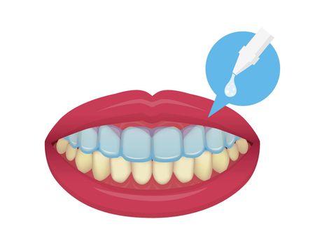 Teeth whitening at home vector illustration / no text