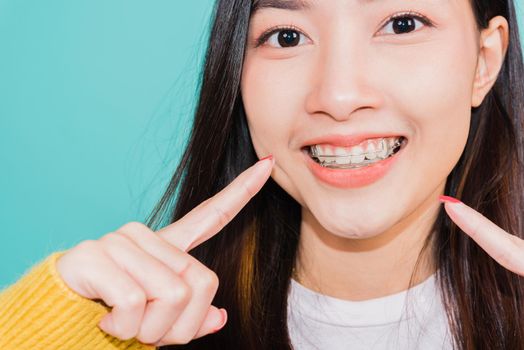 young woman teen pointing finger to teeth