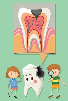 Boy and girl with tooth decay diagram