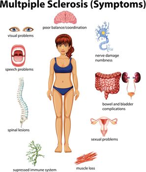 An Education Poster of Multiple Sclerosis
