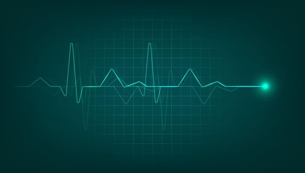 Green heart pulse monitor with signal. Heart beat cardiogram background.
